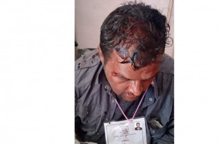 तनहुँमा व्यास नगरपालिका मेयरका उम्मेदवार जोशीमाथि कुटपिट